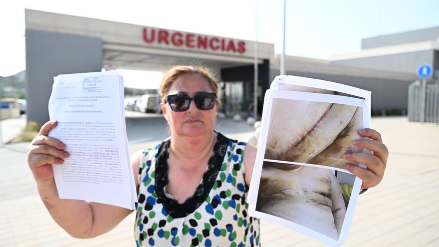 El calvario de Encarna: siete operaciones tras una complicación en una intervención preventiva de cáncer de mama