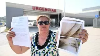 El via crucis de una mujer de Aspe para evitar el cáncer de mama: "Tenía toallas para no mirarme al espejo"