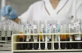 El HUB Alzheimer Barcelona financia tres becas destinadas a investigar en esta demencia