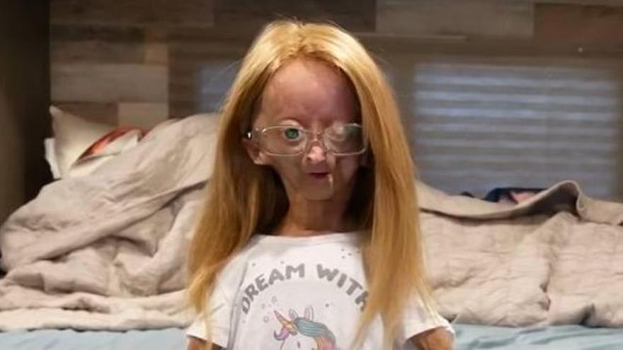 Muere Adalia Rose, la &#39;youtuber&#39; que inspiró la película de Benjamin Button