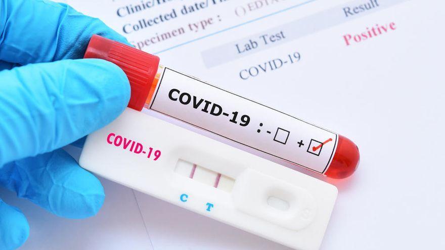 Los datos de la incidencia del coronavirus en Canarias, en abierto y al día.