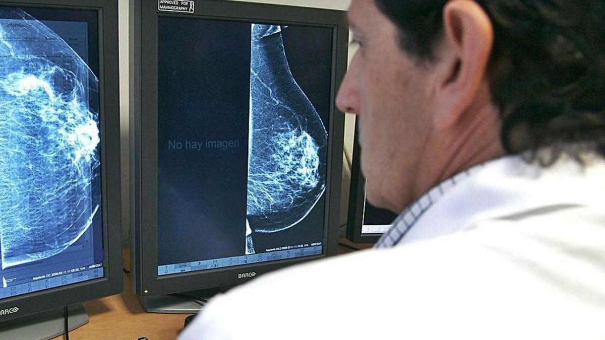 Un médico consulta una mamografía en una pantalla.