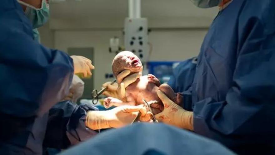Condenan a una aseguradora a pagar una indemnización de casi 13 millones por &quot;negligencia médica&quot; en un parto en Galicia