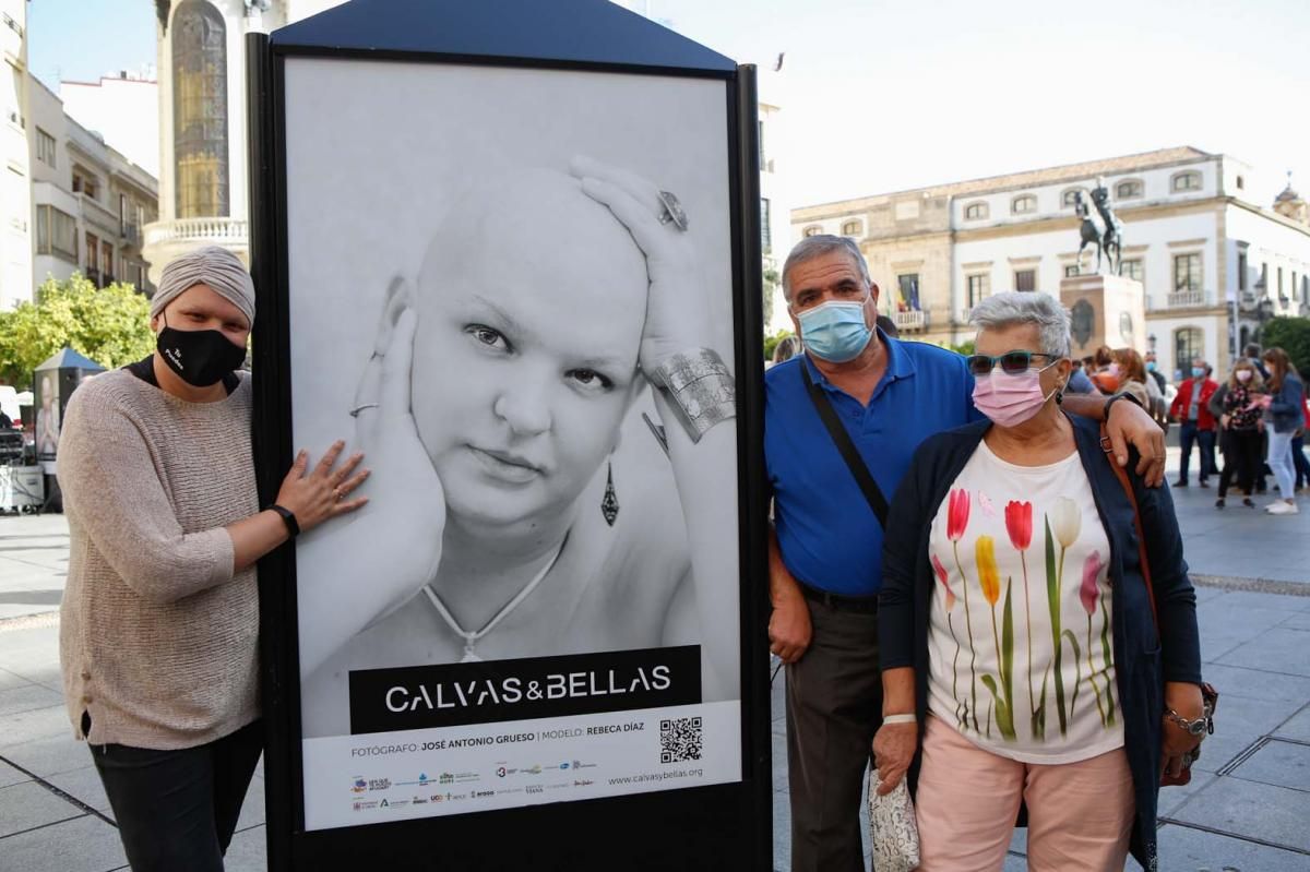 'Calvas y bellas', una invitación a mirar al cáncer a los ojos