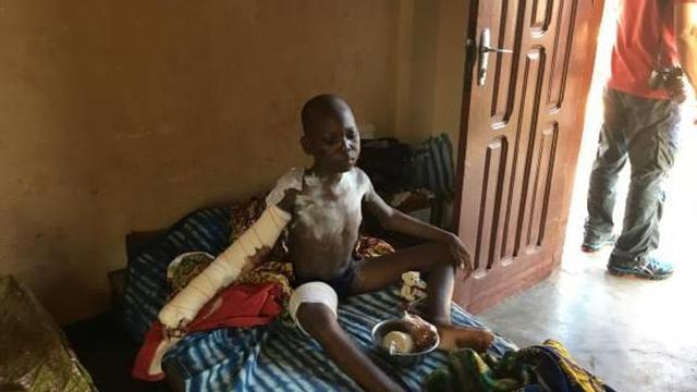 Los «granitos de arena» que permiten a Oasis curar en Togo