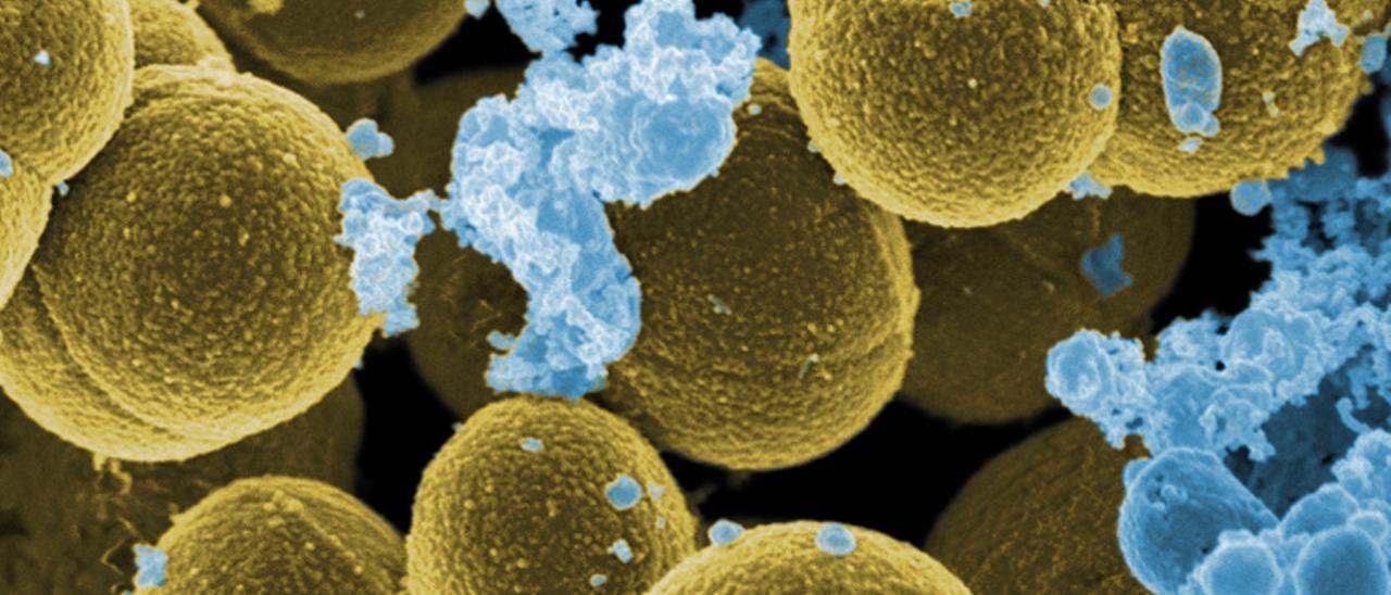 Bacterias Staphylococcus aureus, en amarillo, rodeadas por leucocitos humanos.