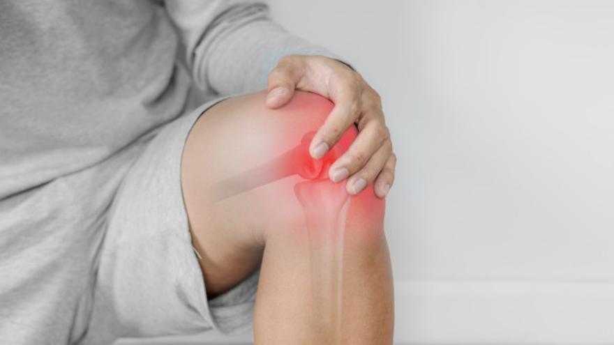 La obesidad, la edad, traumatismos previos y tener antecedentes familiares de artrosis son factores de riesgo para padecer artrosis de rodilla.