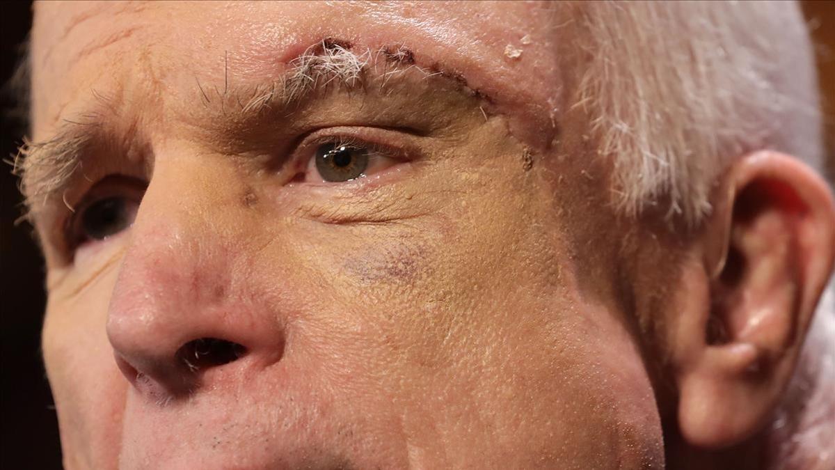 John McCain muestra las huellas de la enfermedad.