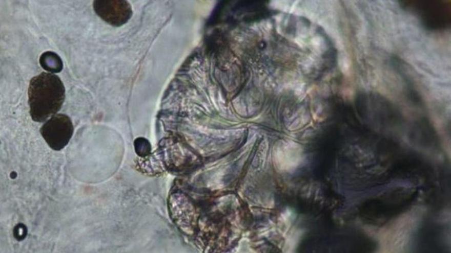 El paràsit de la sarna, detectat en una prova de Muller | Parc de Salut Mar