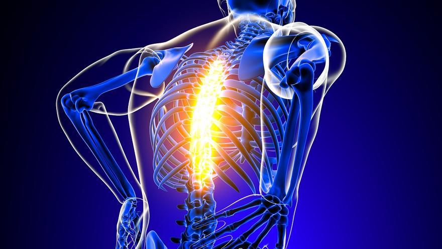 Espondiloartritis anquilosante: cómo prevenir la dolencia reumática que causa rigidez de espalda y dolor