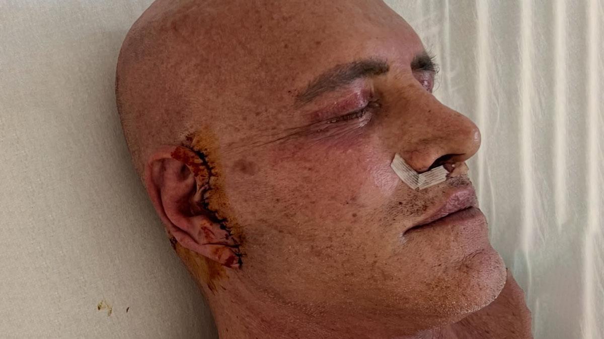 Kiko Matamoros reaparece tras pasar por quirófano para su enésima operación  estética: “Lo hago porque me da la gana”