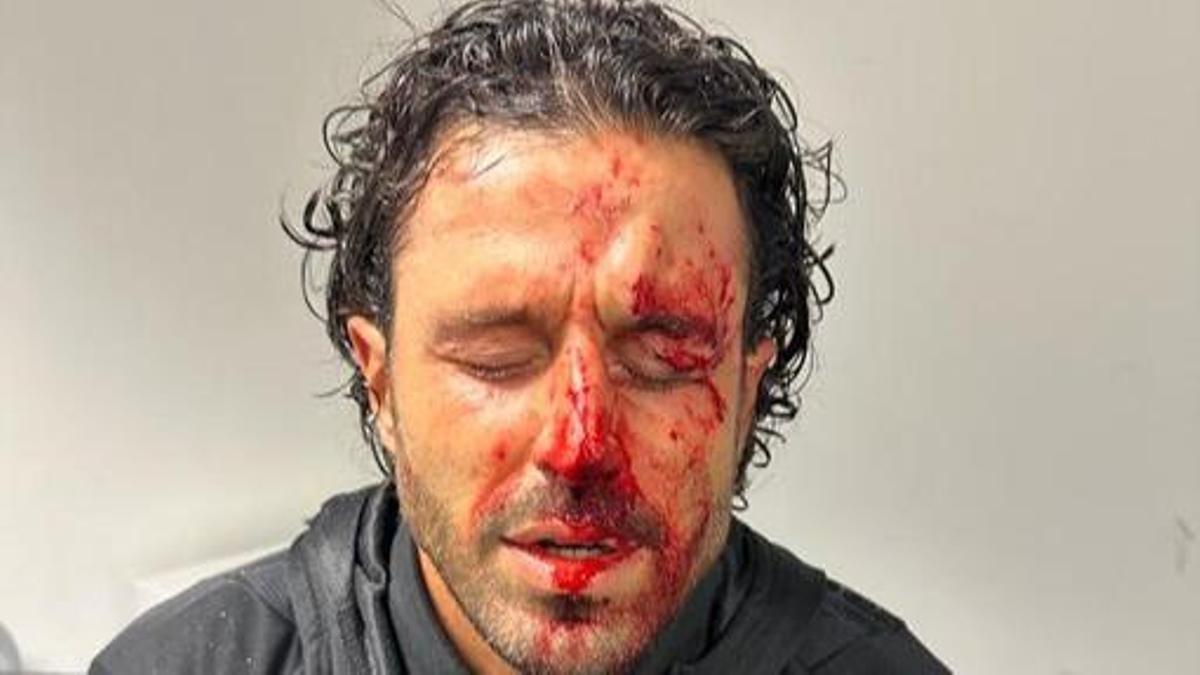 Fabio Grosso, tras ser atendido en los vestuarios del estadio del Marsella.