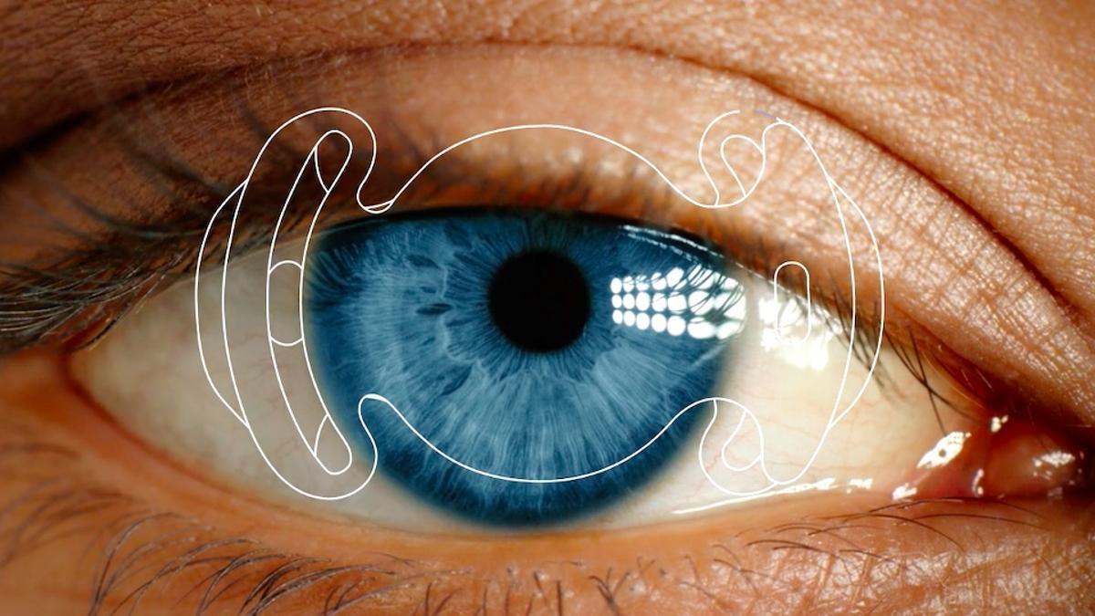 Nueva lente intraocular