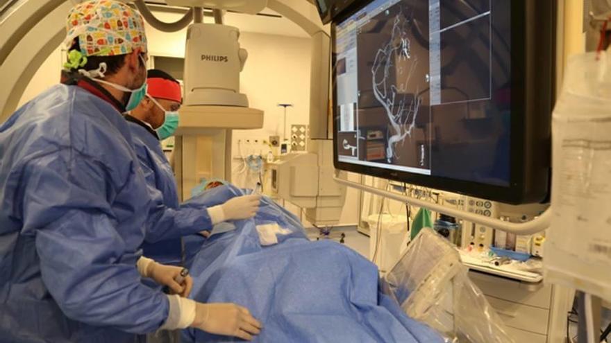 Una imagen de una tromboctomía mecánica realizada en el hospital Vall d´Hebron de Barcelona.