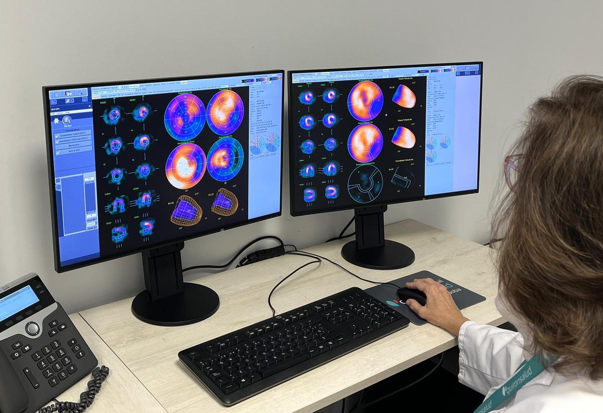 El Hospital Quirónsalud Córdoba incorpora la gammagrafía de perfusión miocárdica para mejorar el diagnóstico cardíaco.