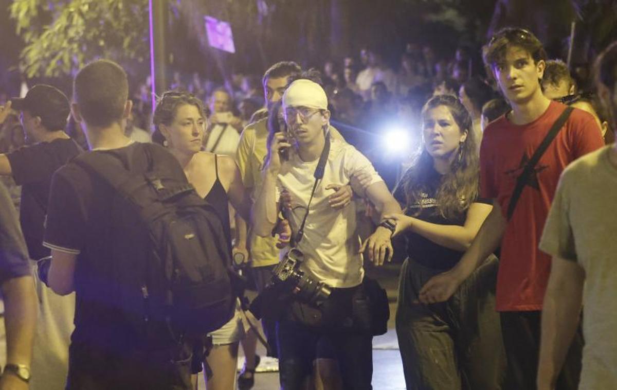 Xavi Hurtado tras la agresión de la que fue objeto por parte de la Policía Nacional mientras cubría las cargas policiales tras la manifestación.