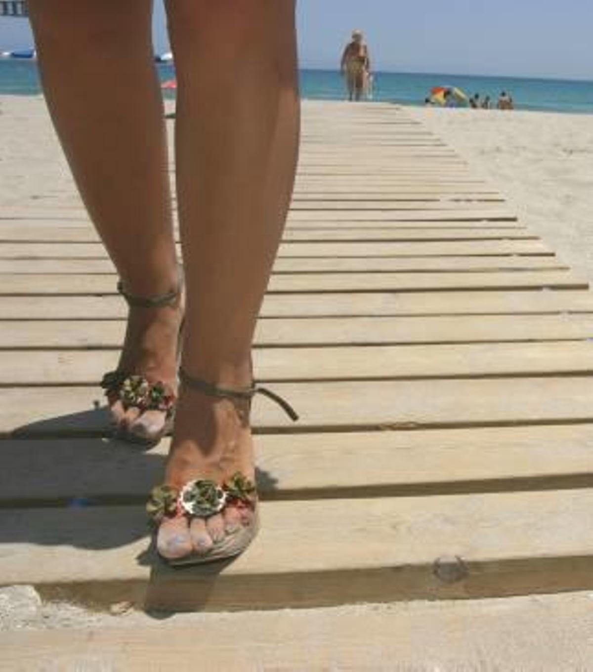 Innovación en el tratamiento de úlceras varicosas y varices: las punciones guiadas por ecografía