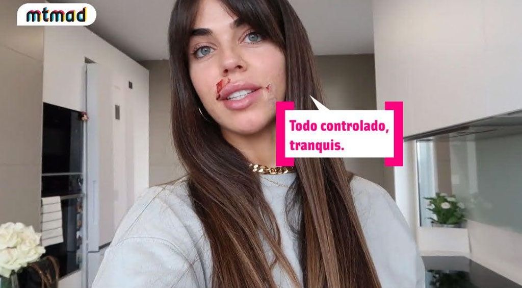 Violeta Mangriñán enseña cómo un cirujano le tapó el agujero del piercing