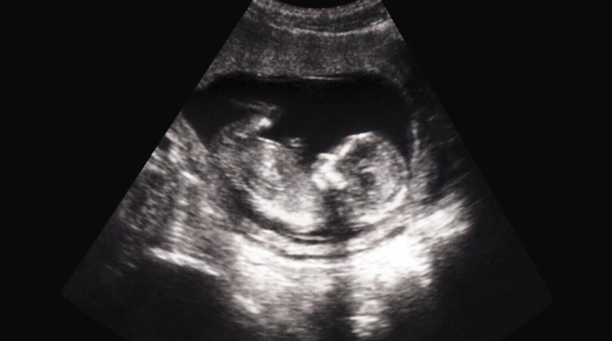 Ecografía de un feto de 14 semanas.