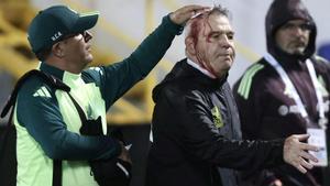 Javier Aguirre, el seleccionador de México, sangra trs ser golpeado por un objeto en Honduras.