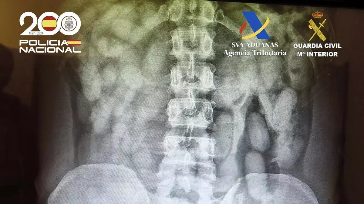 Un detenido en el aeropuerto de Palma llevaba 1,3 kilos de cocaína en el intestino