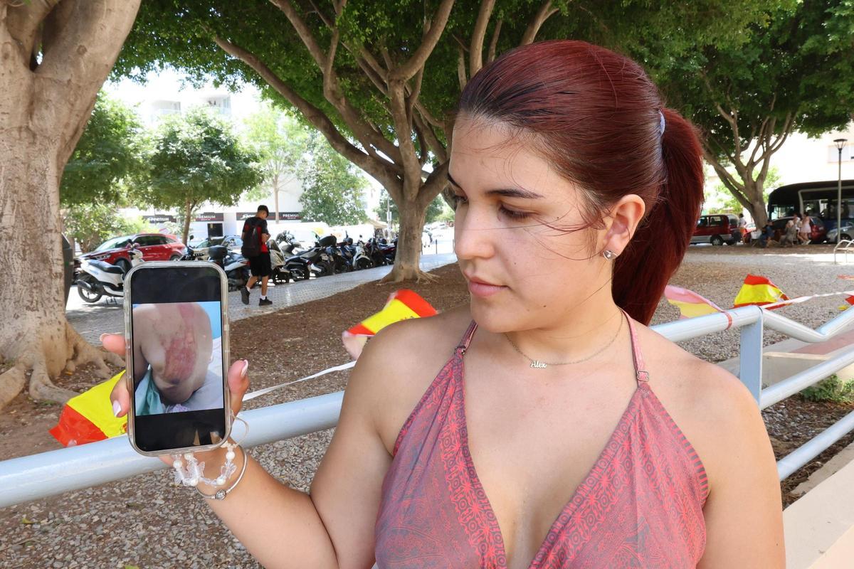 Yenimar muestra las heridas de su padre a través de su teléfono.