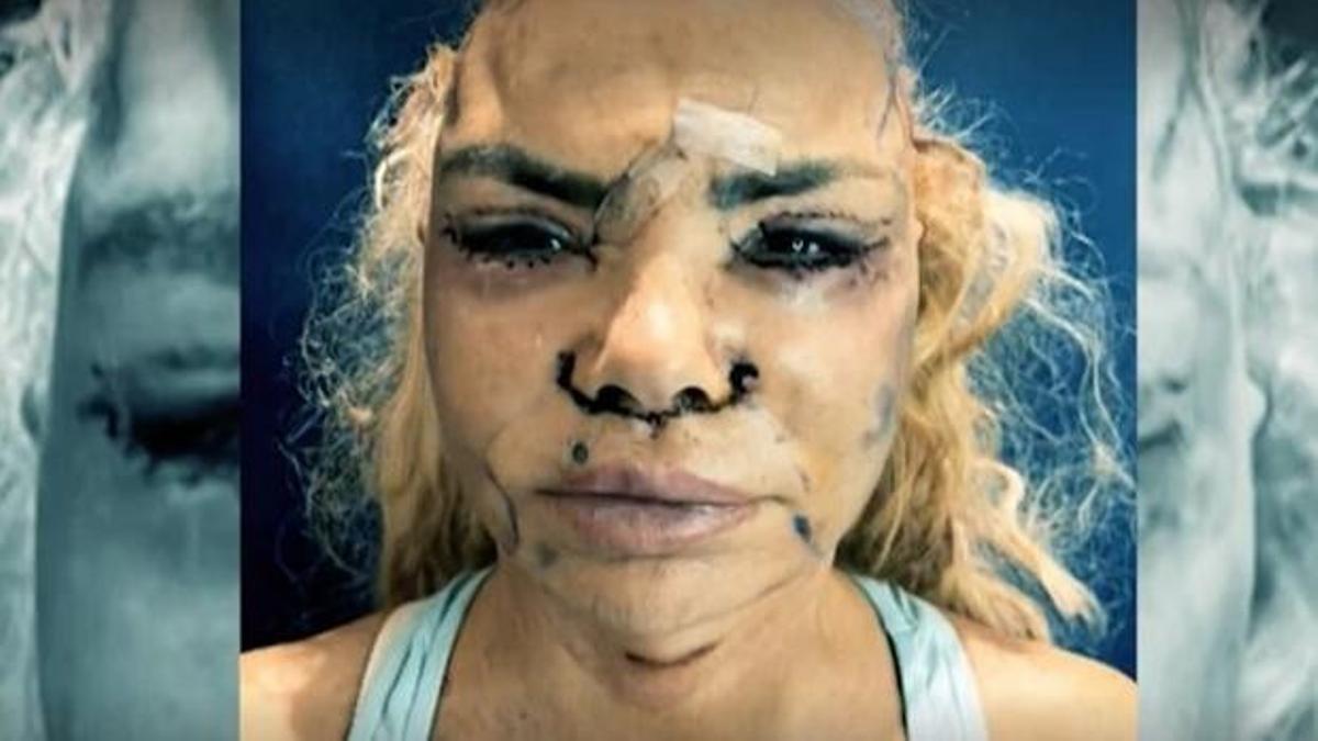 Leticia Sabater se ha retocado los pómulos, los ojos, los pechos, los glúteos y la nariz en su última operación.