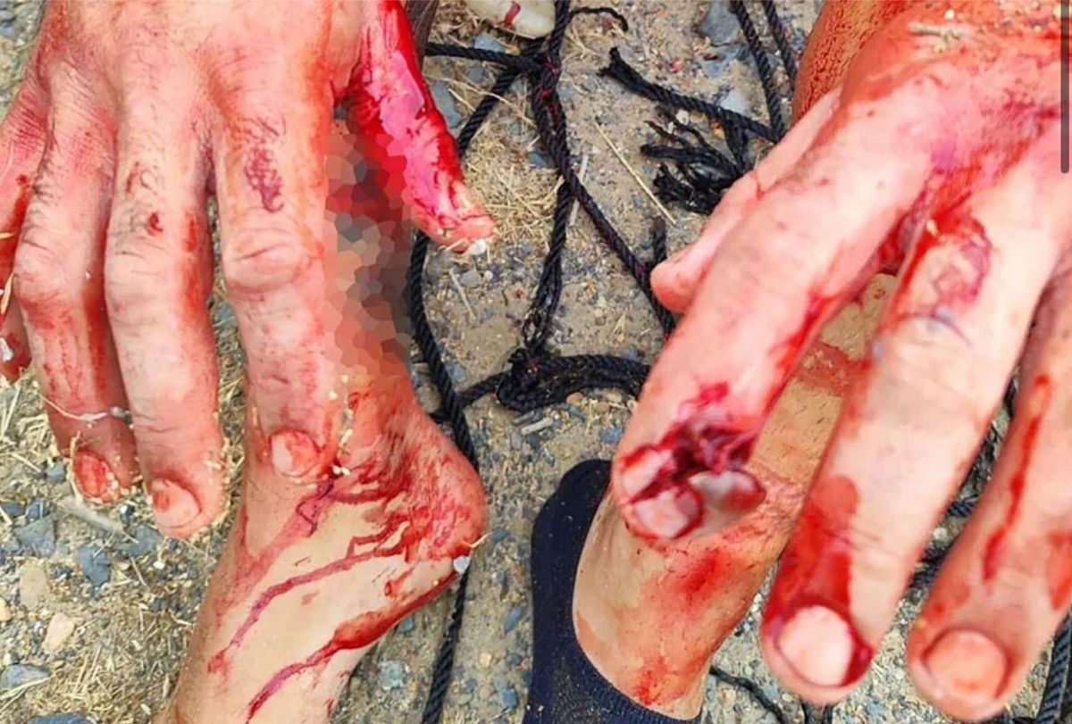 Fotografía de las manos y pies en el momento del rescate de la víctima de este secuestro.