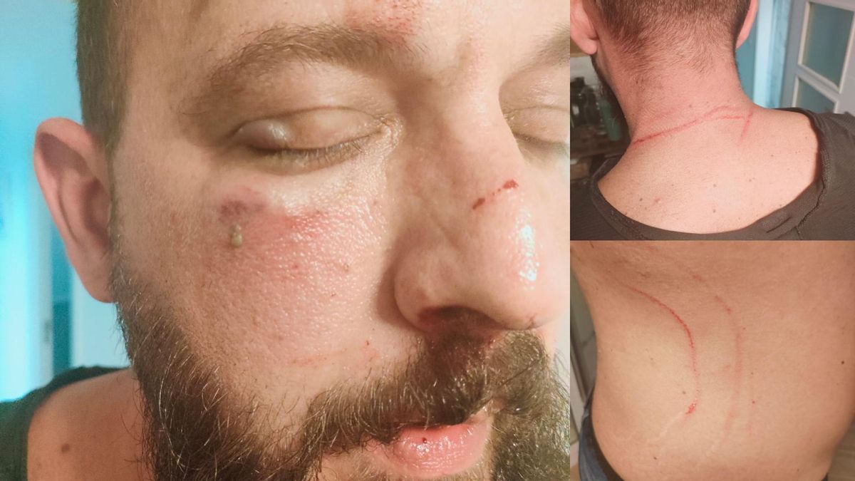 Imagen del guardia civil agredido.