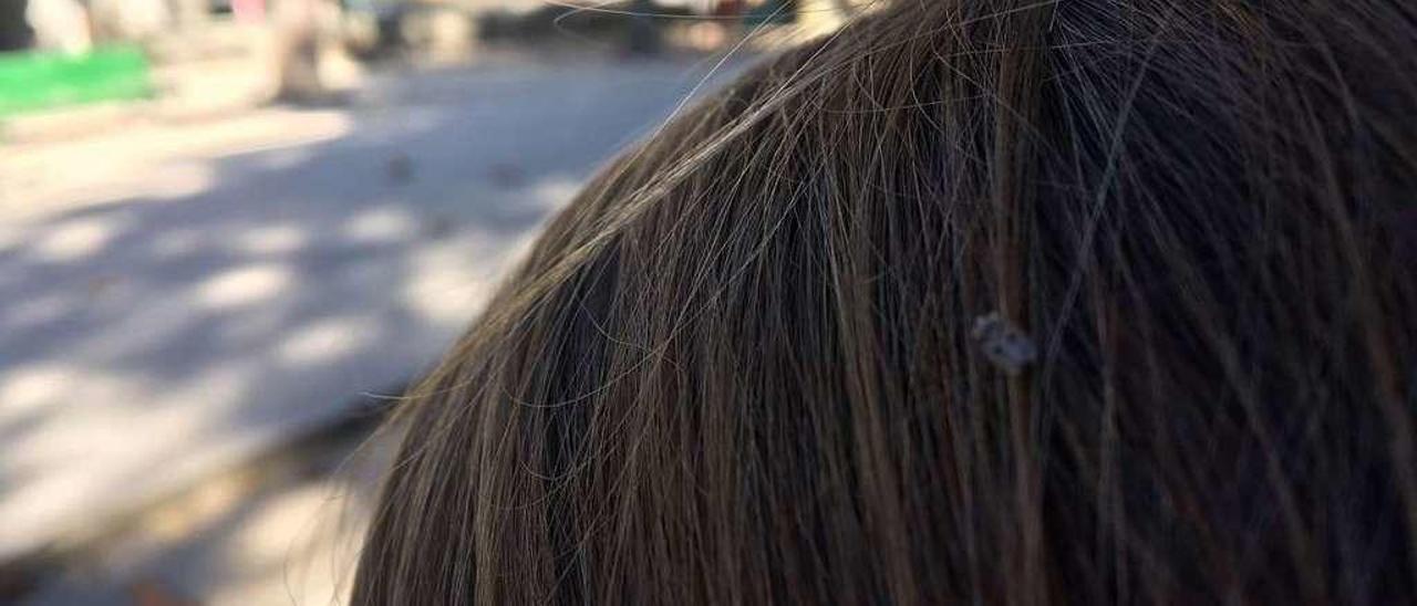 Uno de los insectos, posado en la cabeza de una niña.