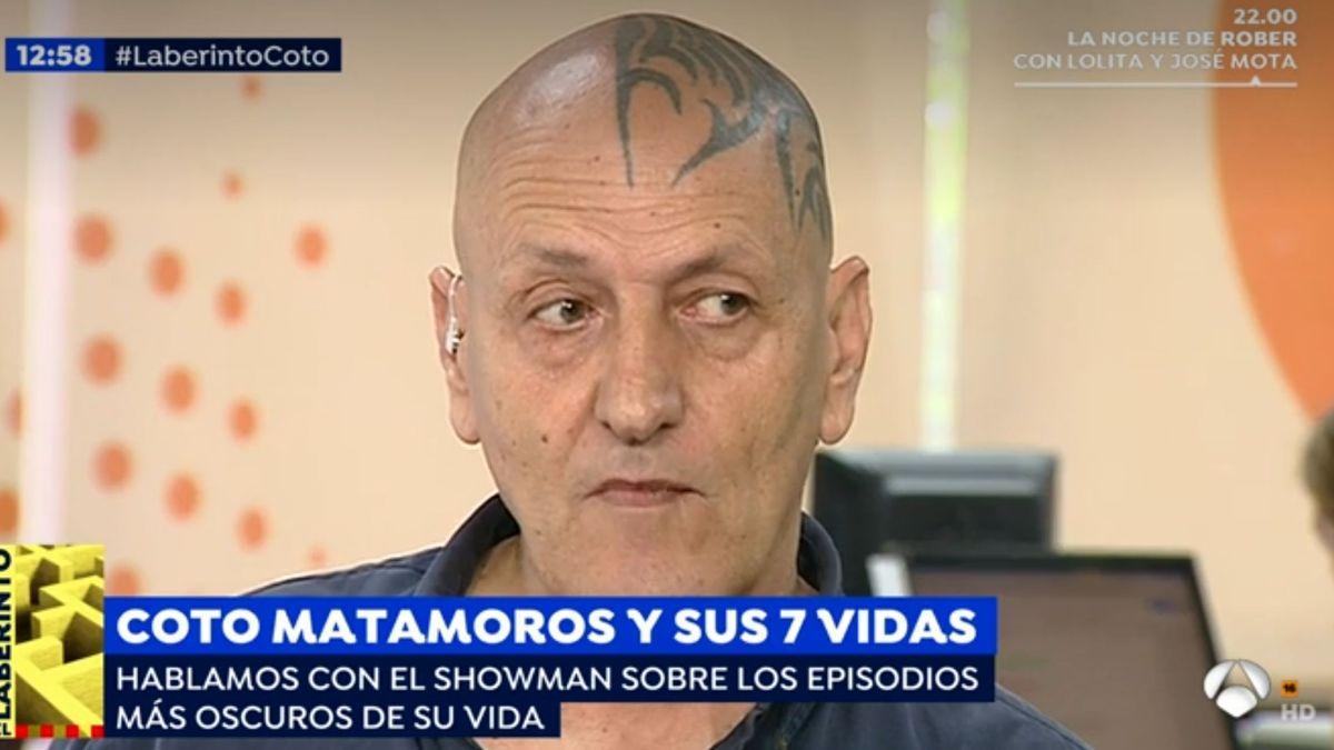 Coto Matamoros luce un característico tatuaje que le ocupa media cabeza.