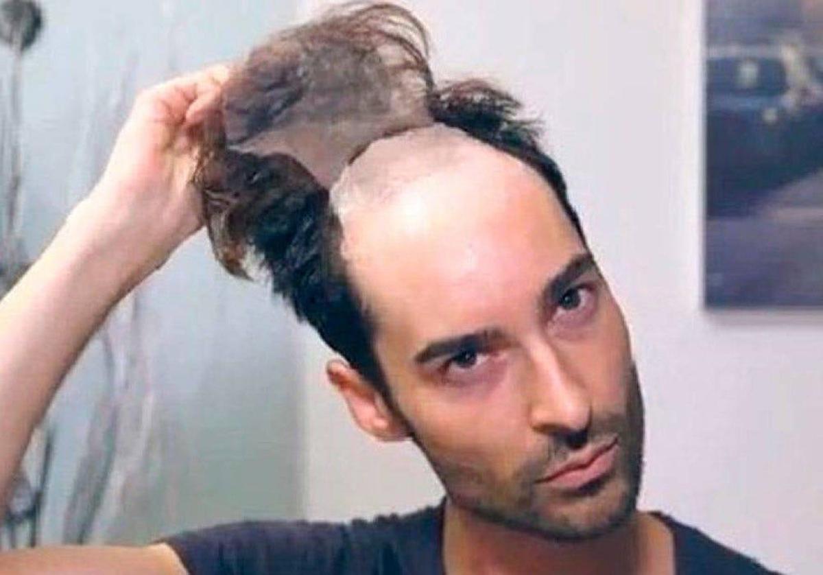 Miguel de Gran Hermano quitándose el peluquín