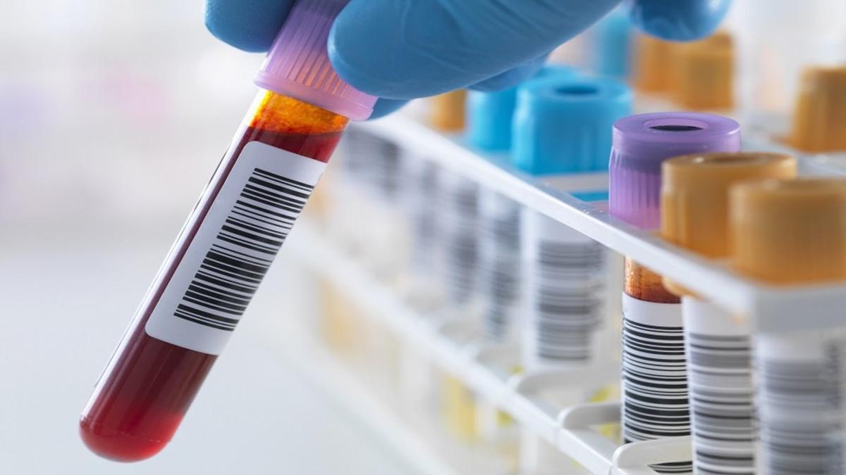 El análisis de sangre que podría alertar de la aparición de un cáncer hasta cuatro años antes