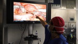 Primera transposición uterina en España para mujeres con cáncer