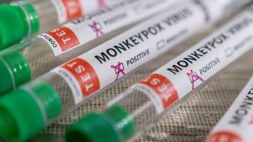 Los casos de viruela del mono siguen aumentando en la Región de Murcia, hasta alcanzar los 31 en la actualidad