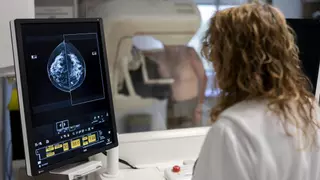 Marcas en los tumores permiten aclarar si el cáncer se debe a causas ambientales: "Empezamos a ver cuáles se deben al tabaco"