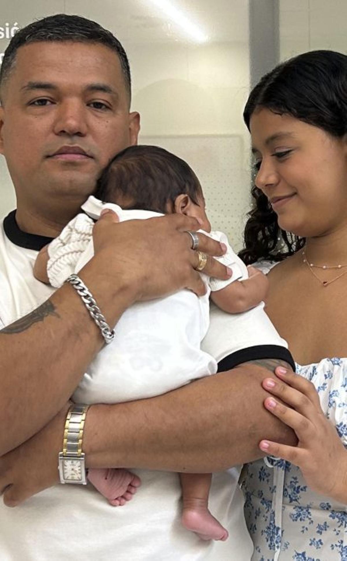 Operat un fetus amb l’intestí desenvolupat fora del cos