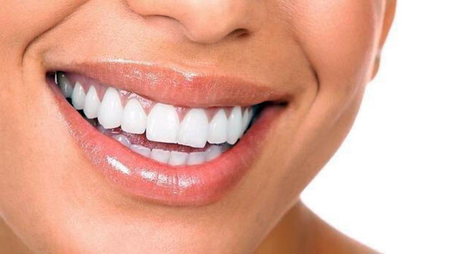 Consejos antes de hacerse un blanqueamiento dental