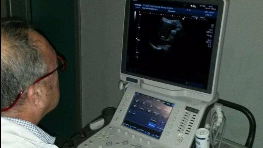 El hospital Virgen de la Peña ya usa el nuevo equipo de radiodiagnóstico