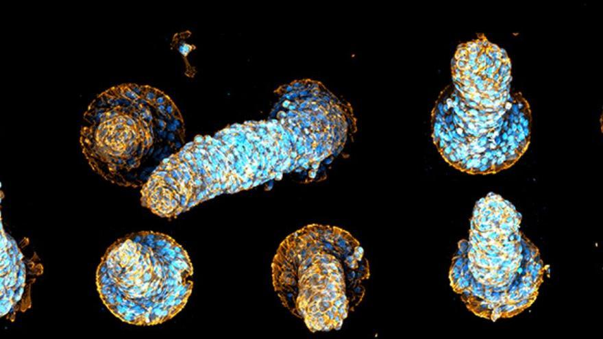 Ejemplos de protuberancias formadas por confinamiento de células musculares en discos adhesivos. Las fuerzas de rotación que actúan generan “tornados celulares” que van dando forma a los órganos.