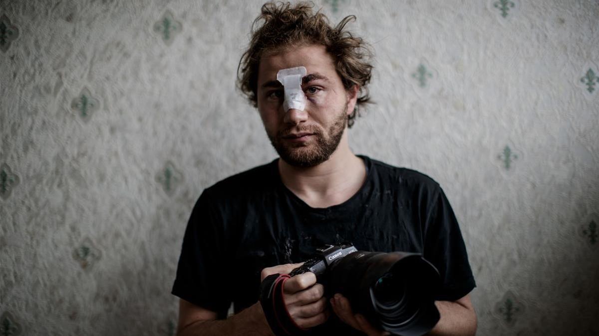 El fotógrafo sirio Ameer al-Halbi tras sufrir la agresión de la policía durante una manifestación el sábado en París.