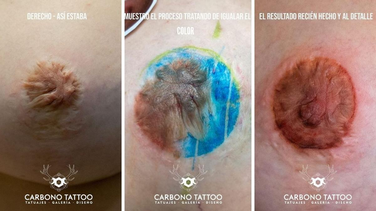 Proceso de un pezón atrofiado a uno tatuado, con varias capas de color de diferentes tonalidades. / CARBONNO TATTOO