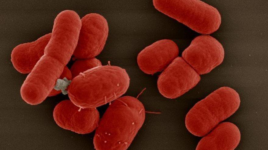 Alertan de una bacteria resistente a antibióticos que se propaga por España