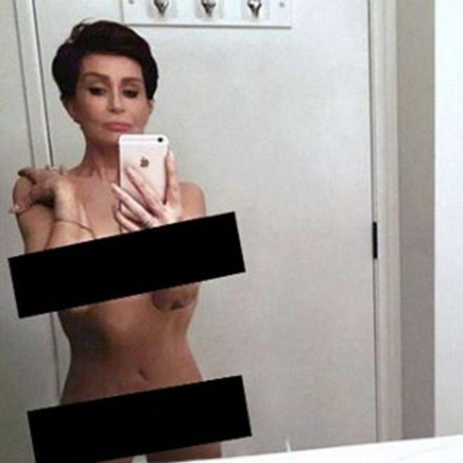 Sharon Osbourne con dos bandas negras en Instagram