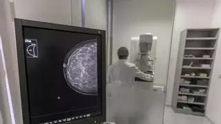 La Conselleria de Sanidad invertirá tres millones en 10 mamógrafos nuevos para agilizar las pruebas