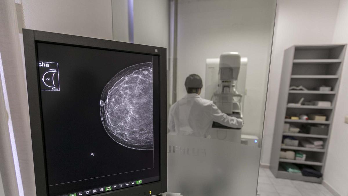 Un mamógrafo del centro de salud de Altabix, en Elche