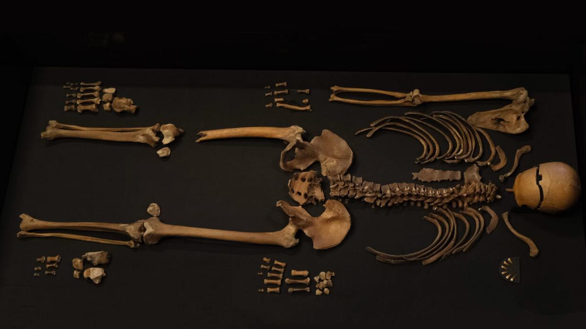 El destino de este hombre en 1197 fue descrito brevemente en la Saga de Sverre y confirmado por el ADN.