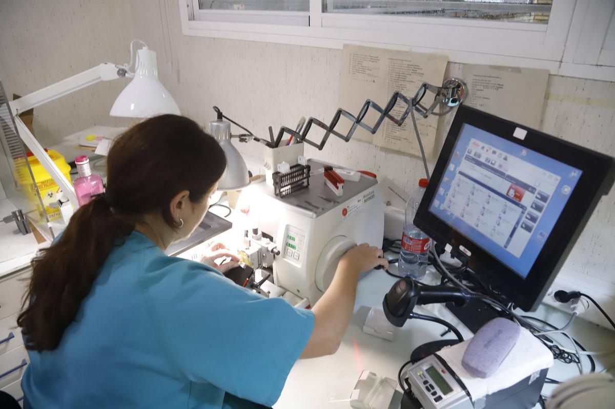 Unidad de Anatomía Patológica del hospital Reina Sofía.