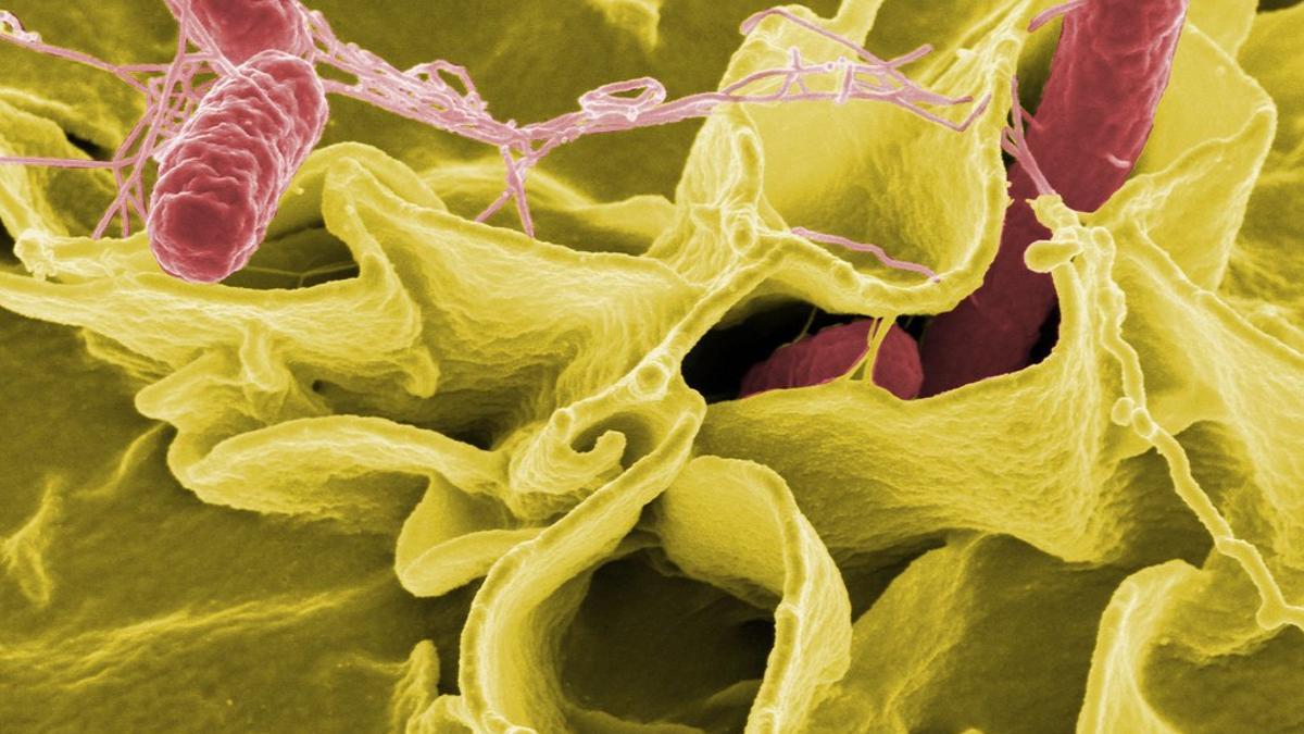 La bacteria Salmonella, causante de la salmonelosis.