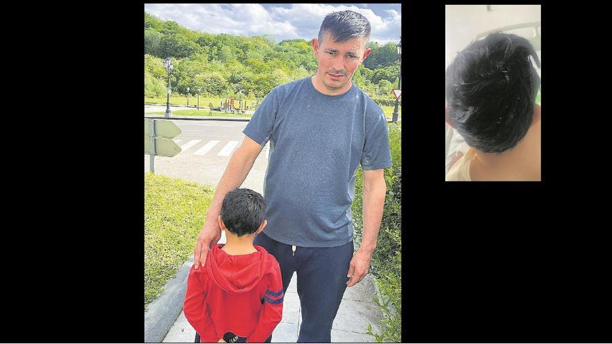 Brutal ataque de un mastín a un niño de 5 años en Oviedo: &quot;Casi morimos del susto&quot;